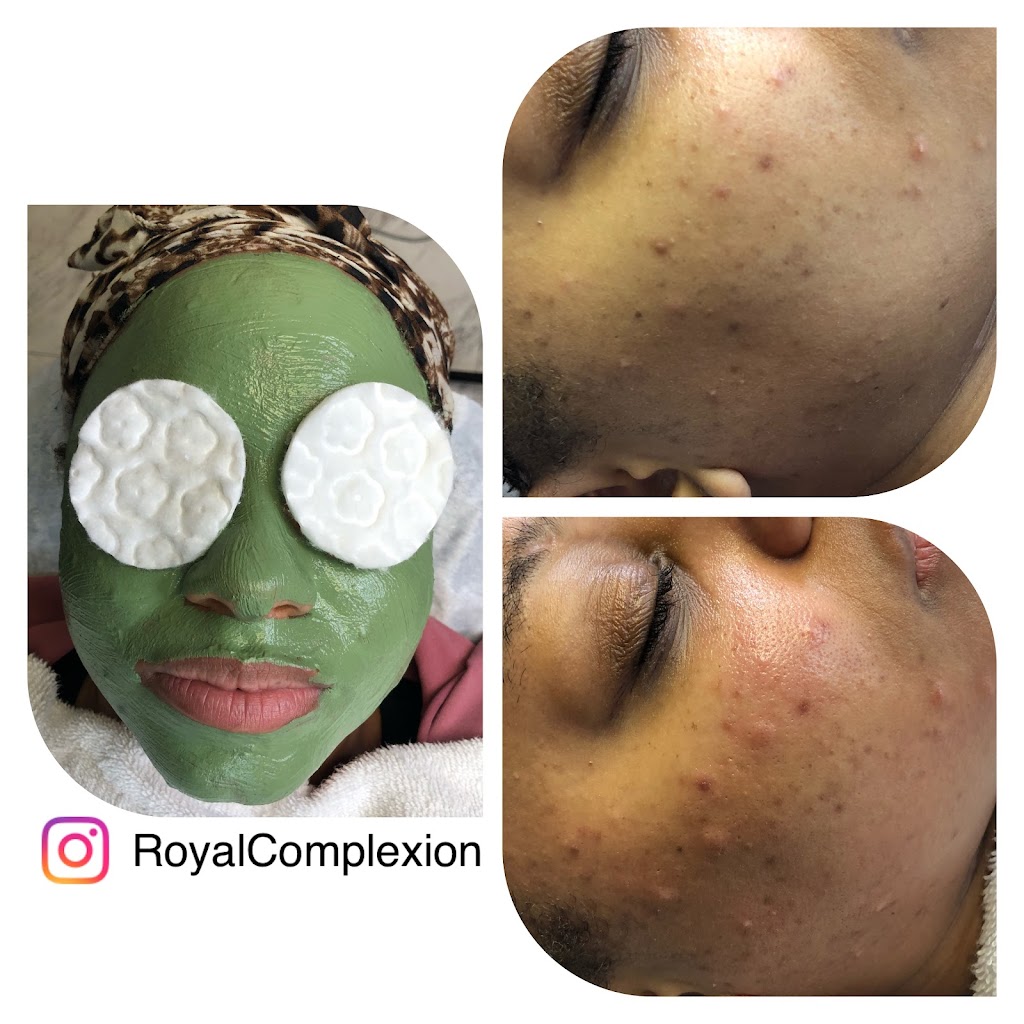 Royal Complexion Parlor LLC | 24326 Mission Blvd Ste 1, Hayward, CA 94544, USA | Phone: (510) 274-1455