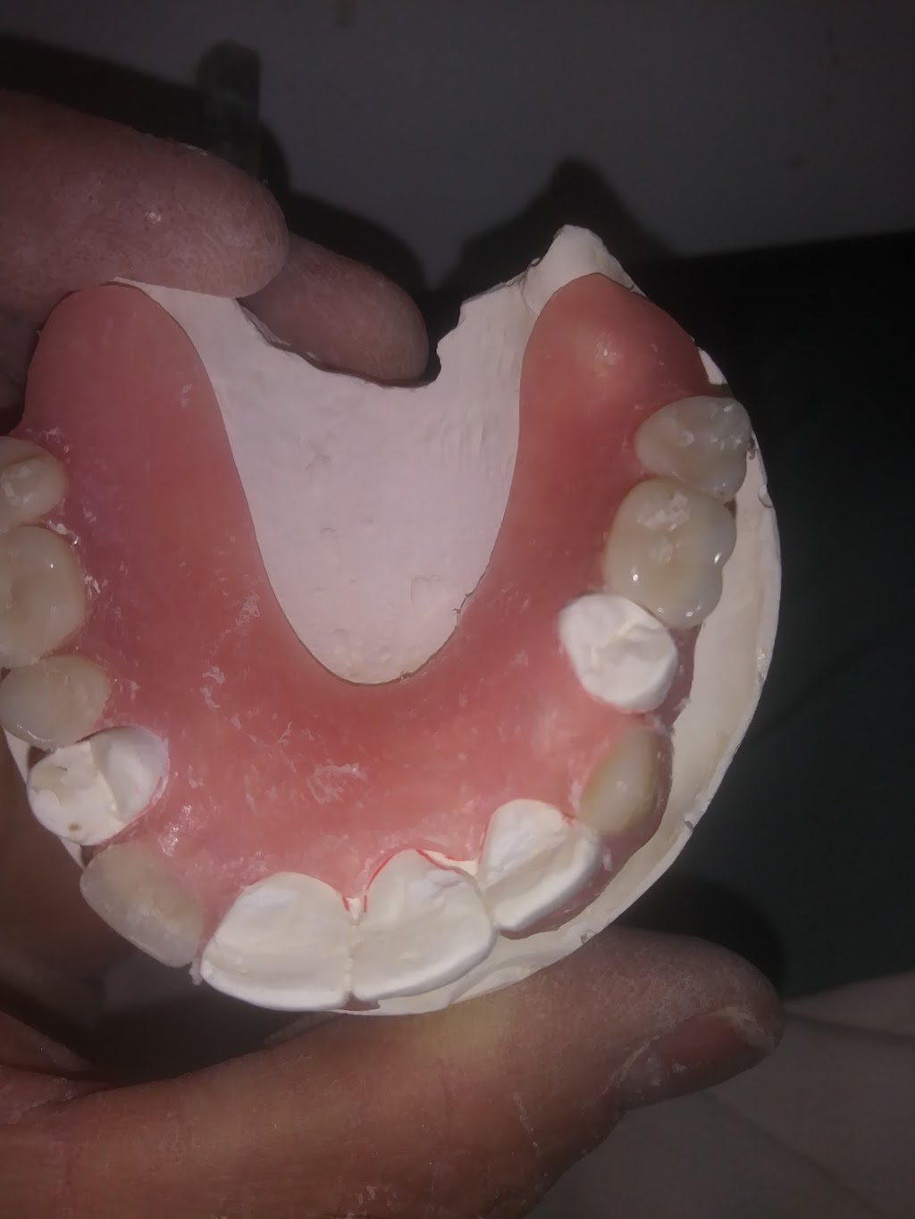 R&B Dental Lab | 21374 Ramona Ave, Apple Valley, CA 92307, USA | Phone: (760) 261-2425