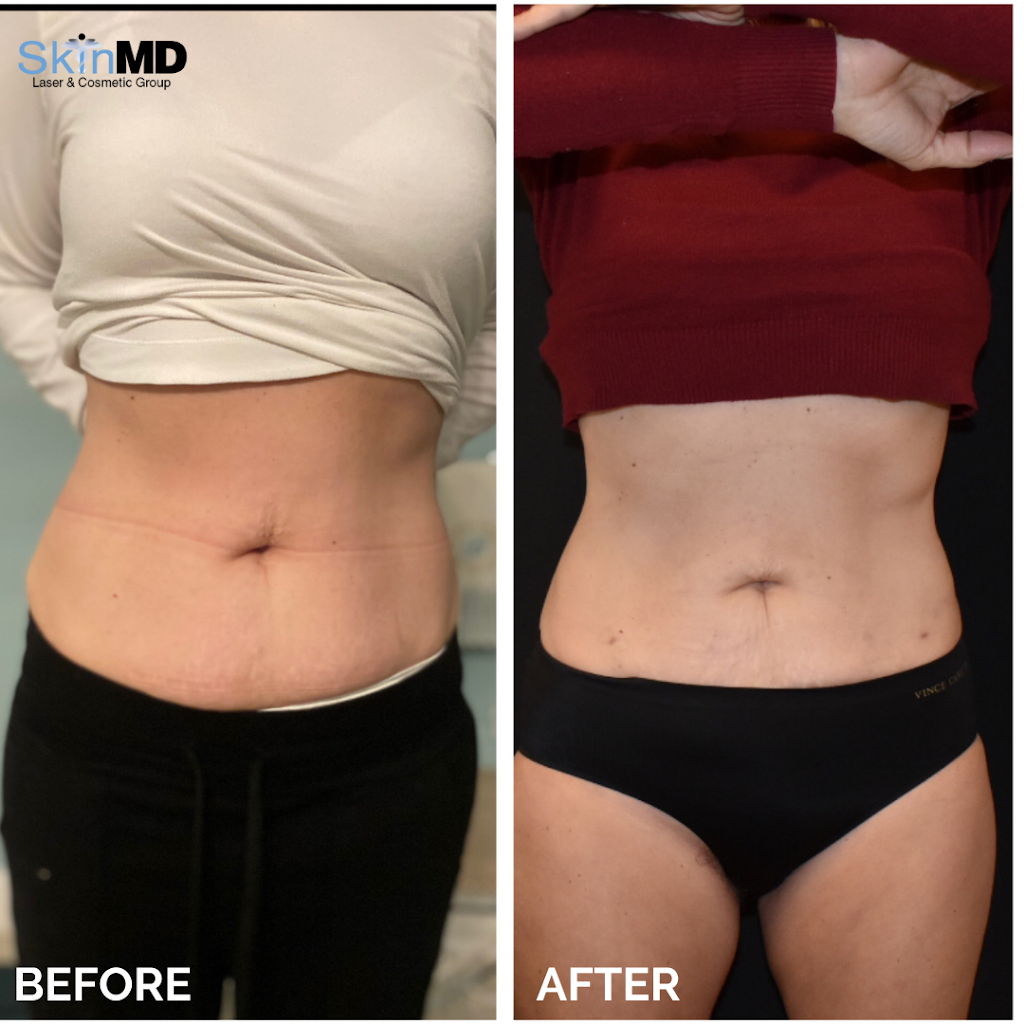 Skin MD Norwell | 400 Washington St, Norwell, MA 02061, USA | Phone: (781) 659-4900