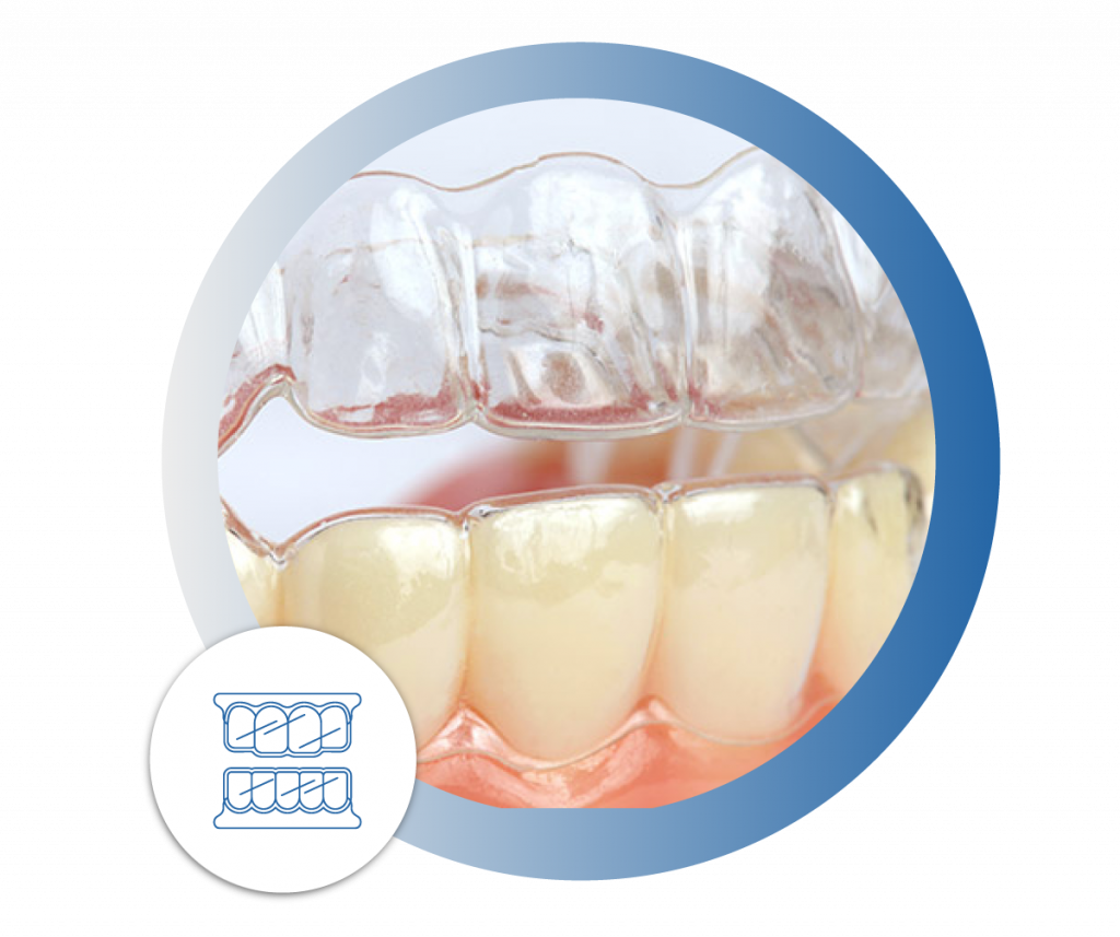 Invisalign Laguna Niguel | 27150 Alicia Pkwy Ste J, Laguna Niguel, CA 92677, USA | Phone: (949) 362-4905