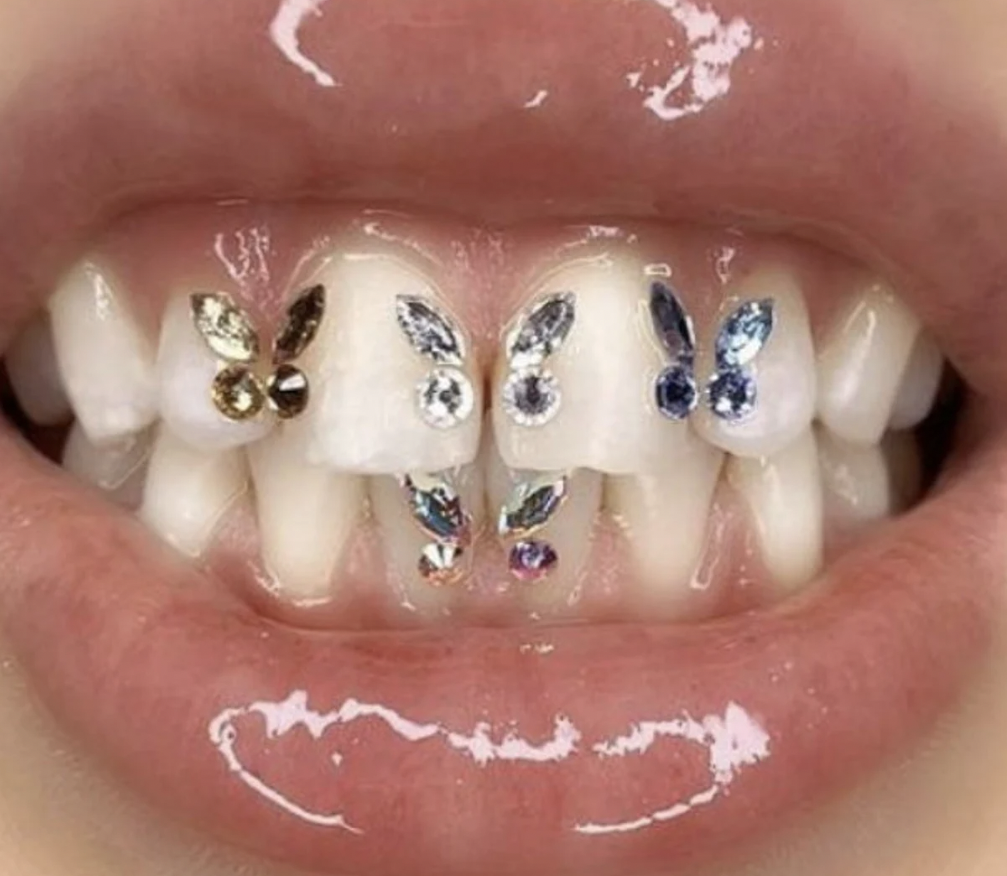 Calirose Tooth Gems | 5114 E Southern Ave Suite 112, Mesa, AZ 85206, USA | Phone: (623) 272-0606