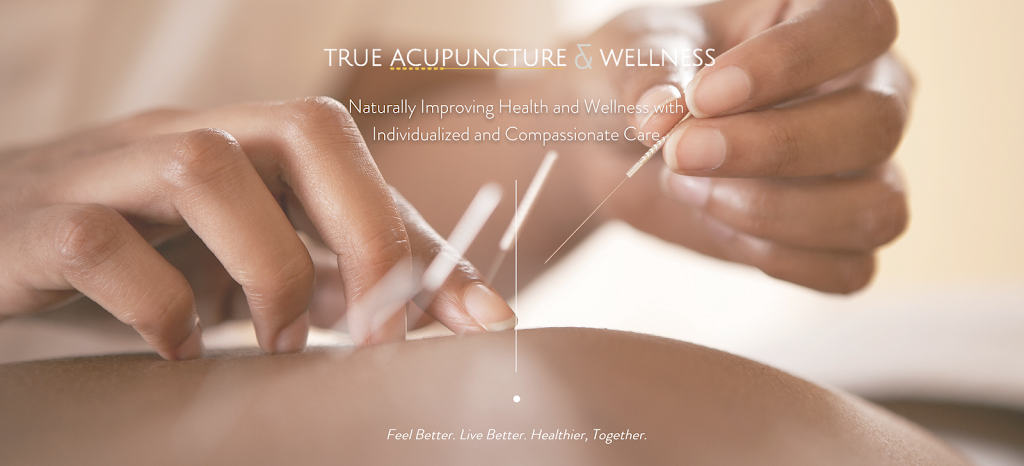 True Acupuncture and Wellness | 1000 Physicians Way #144, Franklin, TN 37067, USA | Phone: (615) 975-7320