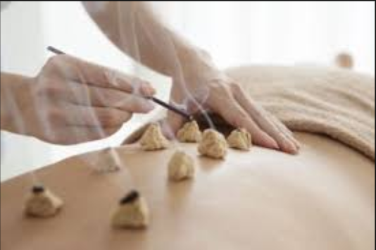 Nature Acupuncture & Herbal Clinic | 3883 Rogers Bridge Rd STE 302A, Duluth, GA 30097, USA | Phone: (470) 858-7030