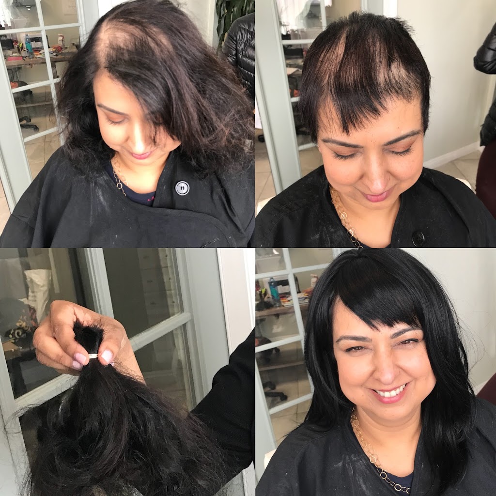 Hair Recovery Treatment Center | 1523 S La Cienega Blvd, Los Angeles, CA 90035 | Phone: (424) 600-8484